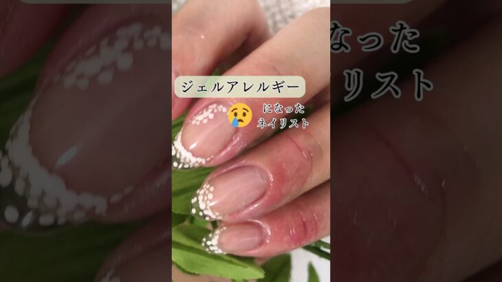 【ジェルネイルで腫れた！？】ジェルアレルギーになったネイリスト【本当に辛い】 #nailart #nails #ネイル #shorts #爪がボロボロ #ジェルネイルアレルギー