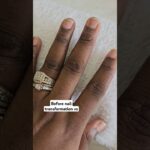 Before nail transformation vs after #shorts #nails #nailtrends #trending