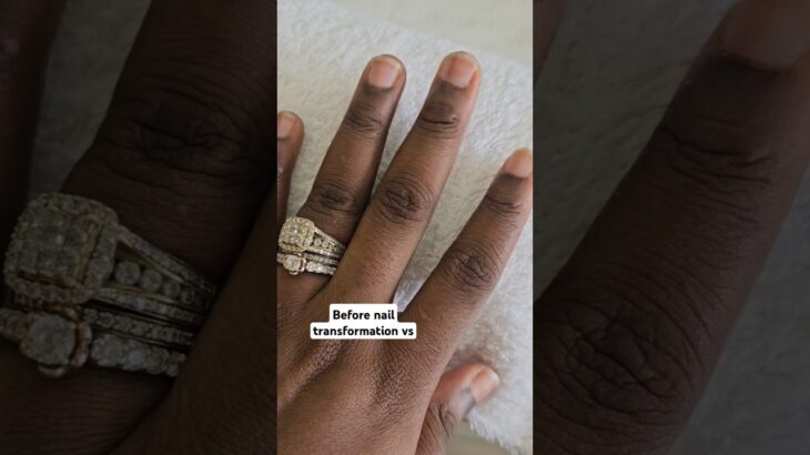Before nail transformation vs after #shorts #nails #nailtrends #trending
