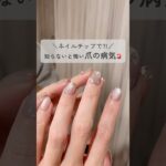 この時期は特に！知らないと怖い爪の病気⚠️ちょっとの知識で防げます◎