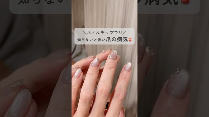 この時期は特に！知らないと怖い爪の病気⚠️ちょっとの知識で防げます◎