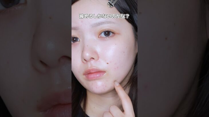 ニキビ肌でも韓国アイドルの美肌は手に入れられます🤫🩵#メイク #ベースメイク #메이크업