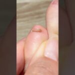 【フットネイル】一応人間の小指です