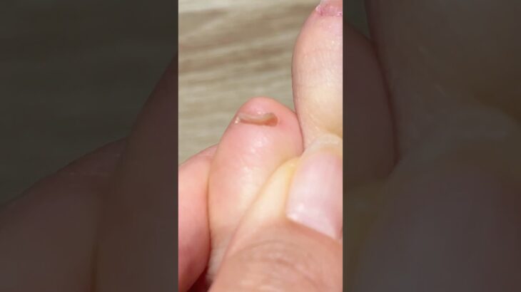 【フットネイル】一応人間の小指です