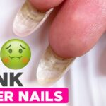 Can These Dirty Nails Be Saved? | Nude Pink and Glitter Nail Art