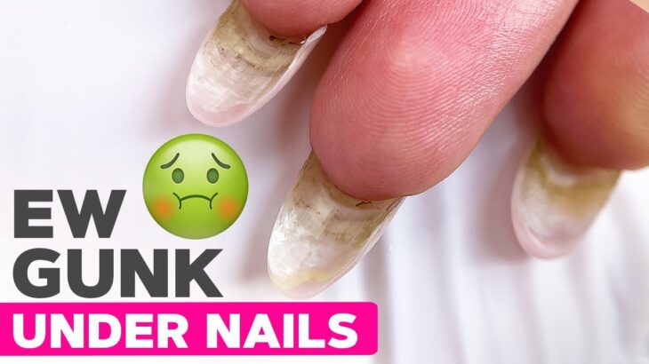 Can These Dirty Nails Be Saved? | Nude Pink and Glitter Nail Art
