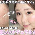 【ニキビ】肌に負担をかけないナチュラルメイク👶🏻🌿垢抜け｜肌荒れ