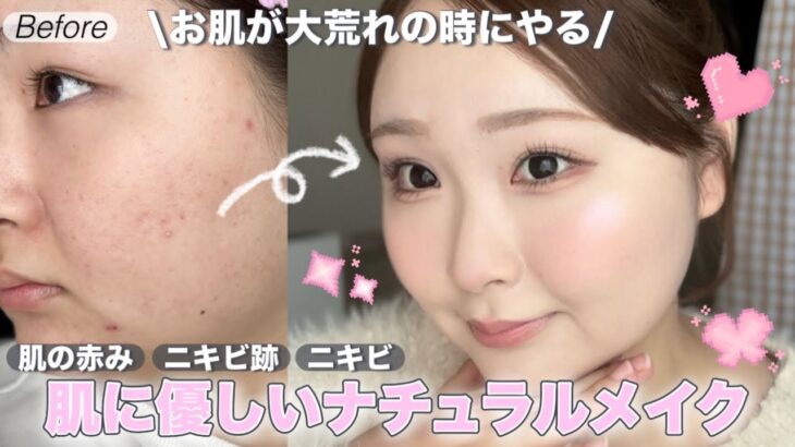 【ニキビ】肌に負担をかけないナチュラルメイク👶🏻🌿垢抜け｜肌荒れ