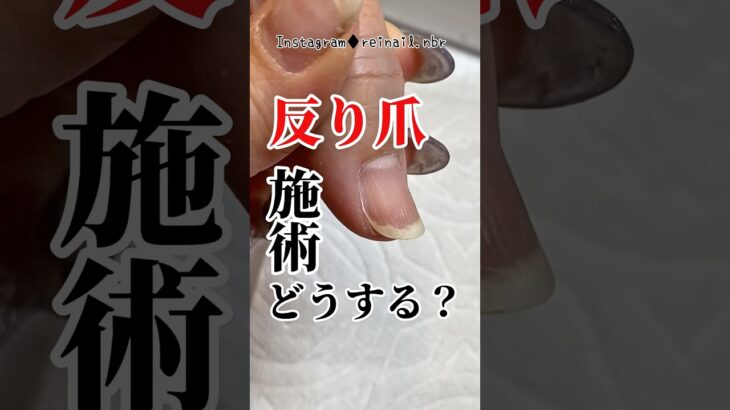 【反り爪💅】まさか、そのまま塗ってねぇよなぁ？！【トラブルの元】 #ジェルネイル