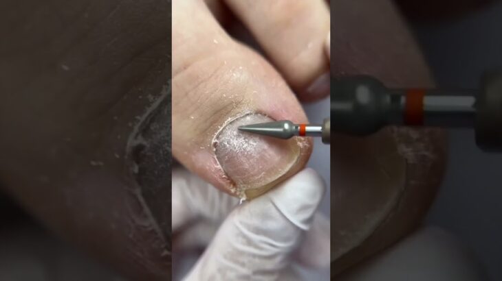 #nails 💅 #nailartheaven #nailartheaven #designnails #nailgelart #naildesign #nailtech #pedicure