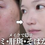 【30代】シミ・肝斑・そばかすをメイクで消す最強の方法！厚塗り感なしでツヤ肌のまま✨