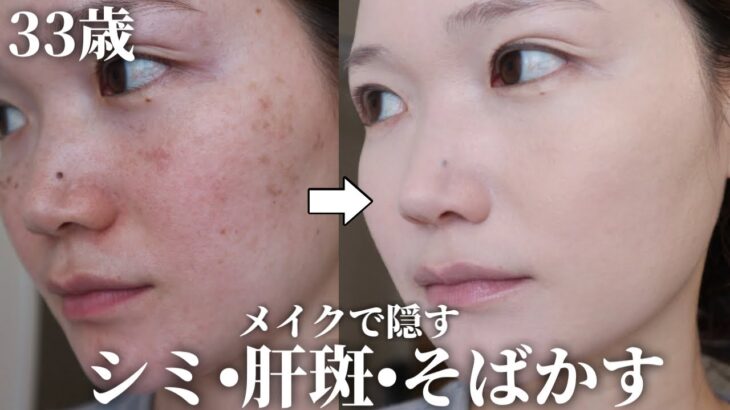 【30代】シミ・肝斑・そばかすをメイクで消す最強の方法！厚塗り感なしでツヤ肌のまま✨