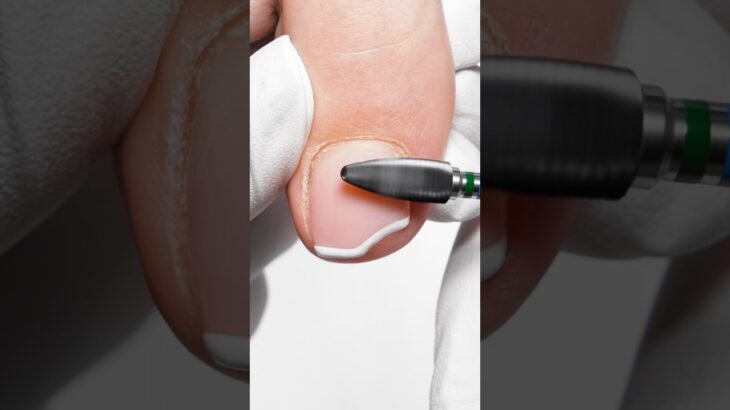 How to fix your broken nail like a pro? 💅✨#melodysusie #nails #nailtech #nailtools #naildrill