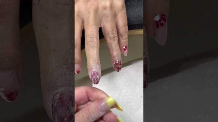 Correcting nail troubles in real time!